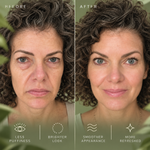 COOLURE® Eyelift PRO
